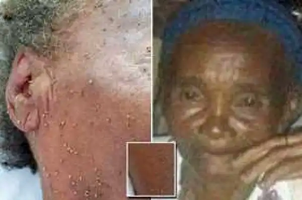 Photos; Grandmother Dies After Being Stung 500 Times By A Swarm Of Bees (Viewers Discretion)
